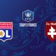 Lyon / Metz (TV/Streaming) Sur quelles chaines et à quelle heure suivre le match de Coupe de France ?