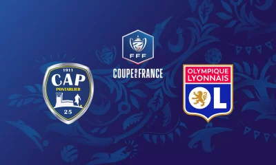 Pontarlier / Lyon (TV/Streaming) Sur quelle chaine et à quelle heure suivre le match de Coupe de France ?